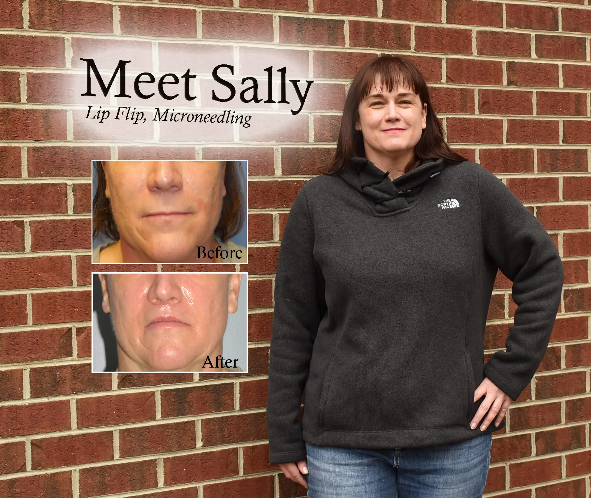 Before and After Pictures in Cary and Fayetteville, NC