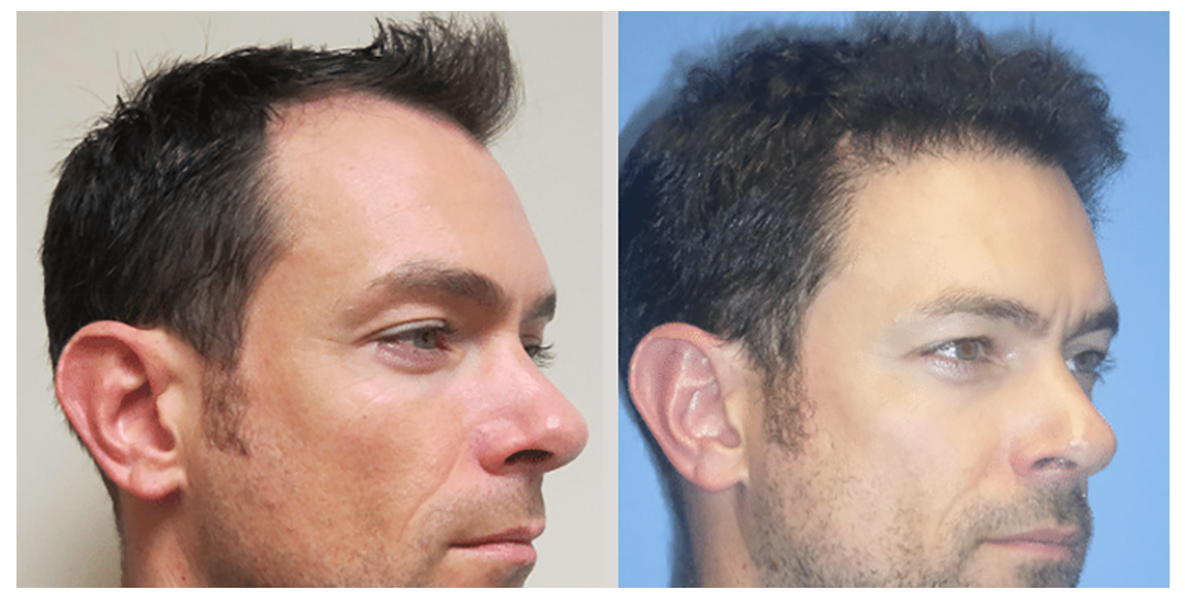 Fayetteville Plastic Surgery | Fayetteville, NC