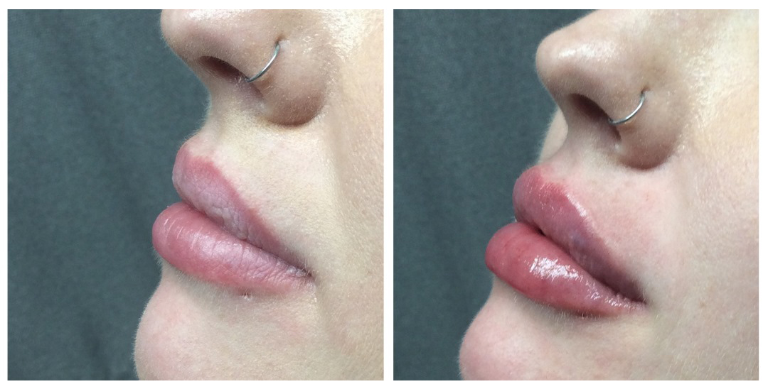 Fayetteville Plastic Surgery | Fayetteville, NC