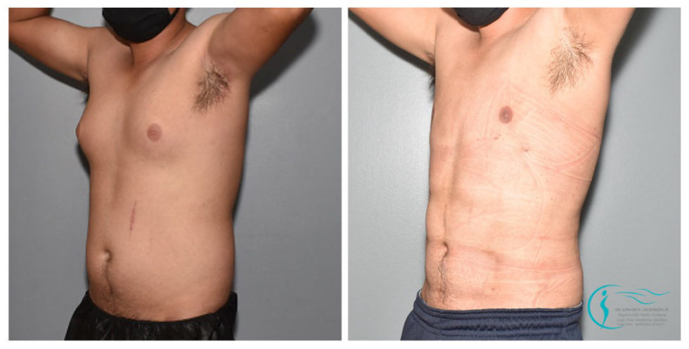 Fayetteville Plastic Surgery | Fayetteville, NC
