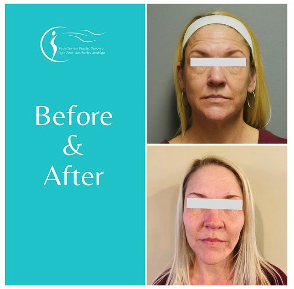 Plastic Surgery & Medical Spa in Fayetteville and Cary, NC