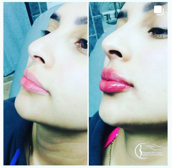 Plastic Surgery & Medical Spa in Fayetteville and Cary, NC