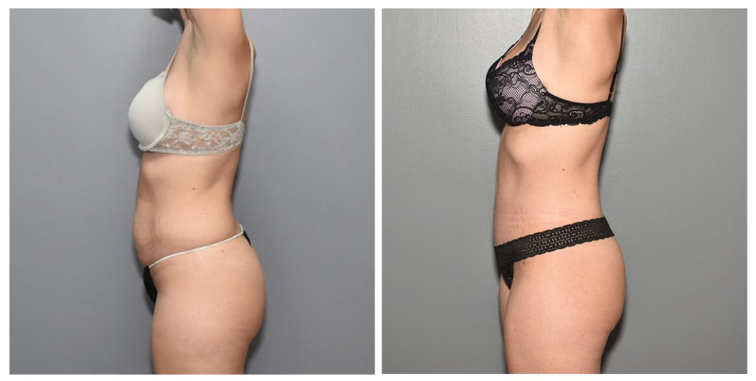 Fayetteville Plastic Surgery | Fayetteville, NC